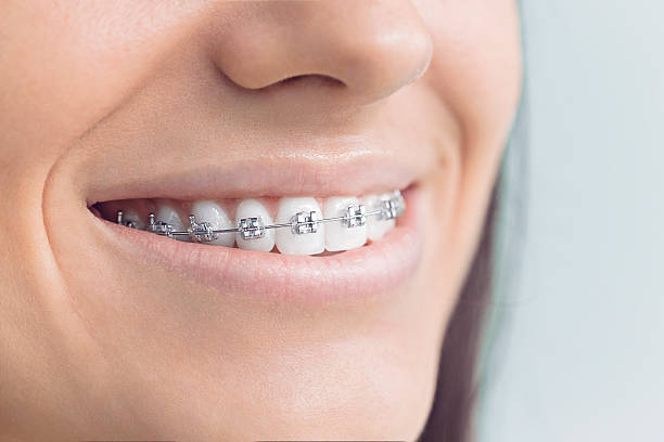 Best Traditional Braces  in Navassa, NC
